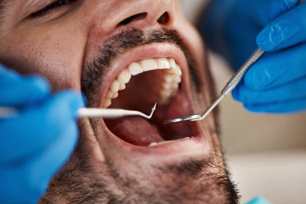 Best 24-Hour Emergency Dentist in Marshville, NC