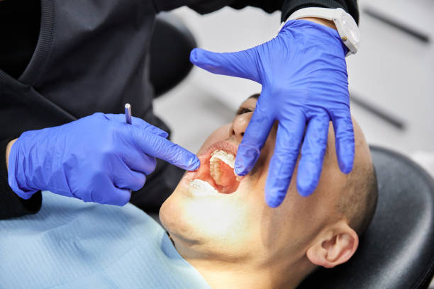 Best Emergency Tooth Extraction in Marshville, NC