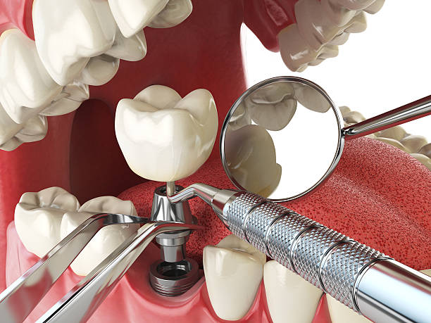 Best Emergency Denture Repair in Marshville, NC